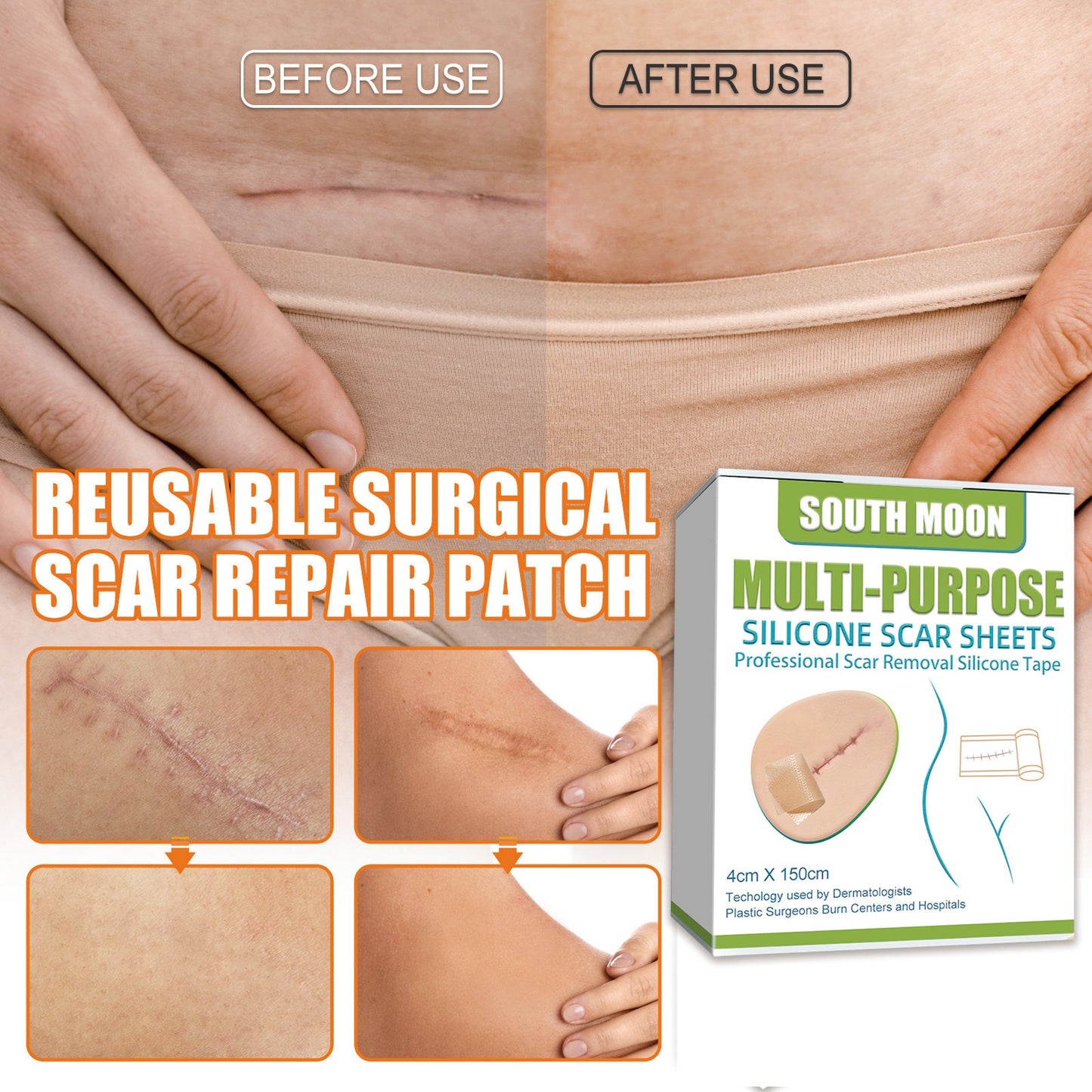 Skin Care Patch for Reducing Skin Imperfections